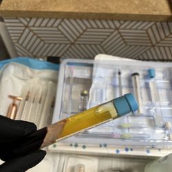 Dermaglow - PRP For Hair thinning/Hairloss