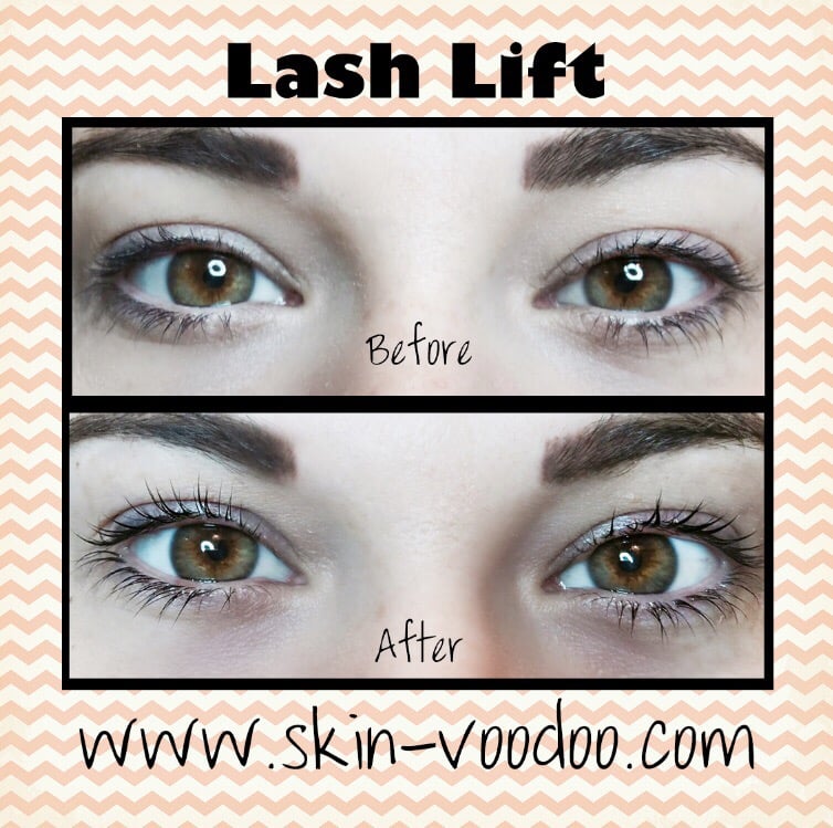 Skin Voodoo Logo