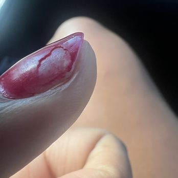 Stella Nail Lounge - 1 day later... - Nail Salons Near Me - Seattle, Washington