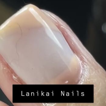 Lanikai Nails - Hair Stuck in Nail - Nail Salons Near Me - Kailua, Hawaii