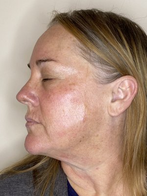 Mirame Skin Treatments by null