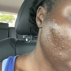 Heena Salon-McKinney - Face 2 days after having it threaded here at Heena salon