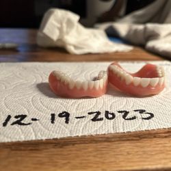 Dentures By Design - To prove we did not do anything to the dentures on our own. This is the date no repairs.