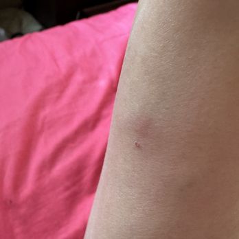AMC Empire 25 - Bed bugs bite , I have more on my legs - Cinema Near Me - New York, New York