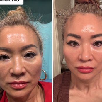 Elane Skin Care and Cosmetics - First photo before, after photo. Will update photo after touch up. - Skin Care Near Me - Houston, Texas Elane Skin Care and Cosmetics - First photo before, after photo. Will update photo after touch up. - Skin Care Near Me - Houston, Texas