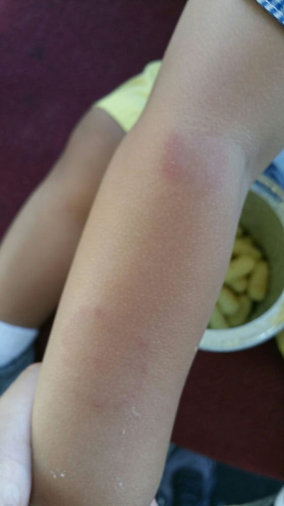 Another Best Child Care At Whispering Pines - childcare center in Lynnwood, WA