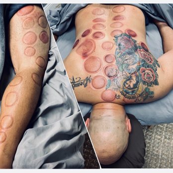 Knotted Up - Massage Therapy Near Me - Rancho Cucamonga, California