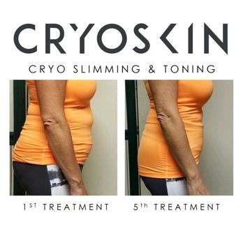 Advanced Regeneration - We have the most competitive prices for Cryoskin Slimming and Toning in Dallas! - Pain Management Near Me - Dallas, Texas