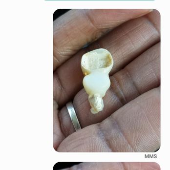 Daraie Dental Group - Bridge fell out of my mouth after 2 1/2 weeks - General Dentistry Near Me - Los Angeles, California