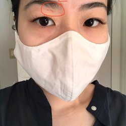 iBrow ThreadnWax - Bleeding cuts under my right eyebrow. Eyebrows don't look that thin as this is a closeup shot and no Before photo to compare with.