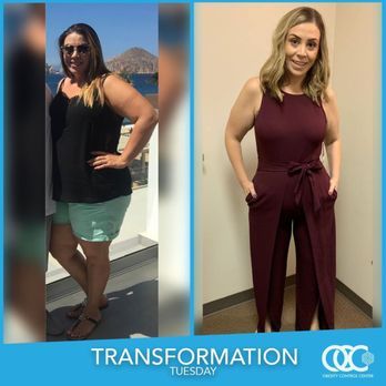 Obesity Control Center - Check out more amazing weight loss transformations on our website! obesitycontrolcenter.com/stories - Weight Loss Centers Near Me - Tijuana, BCN Obesity Control Center - Check out more amazing weight loss transformations on our website! obesitycontrolcenter.com/stories - Weight Loss Centers Near Me - Tijuana, BCN