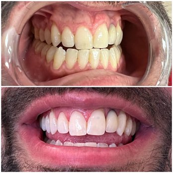 Beauty Box SF - LED Teeth Whitening - Eyelash Service Near Me - Burlingame , California Beauty Box SF - LED Teeth Whitening - Eyelash Service Near Me - Burlingame , California