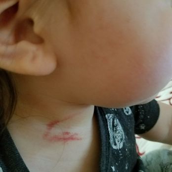 Moore Than Just Sittin Childcare - This is the scratch my son got while being under her care! - Child Care & Day Care Near Me Moore Than Just Sittin Childcare - This is the scratch my son got while being under her care! - Child Care & Day Care Near Me
