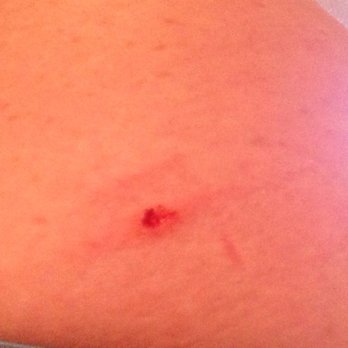 Pawsitive Veterinary - The gash I got bumping into the corner of their table - Pet Services Near Me - Brooklyn, New York