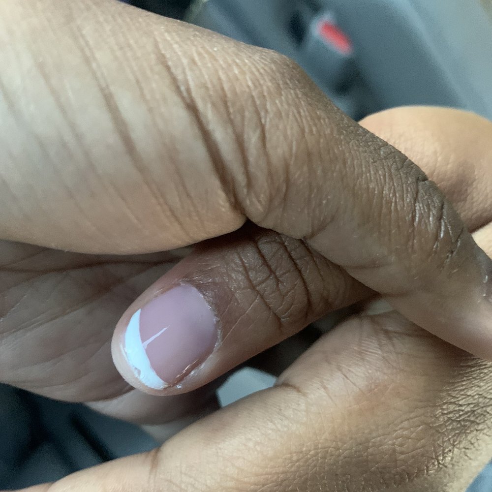Fantastic Spa - This nail was like that and no one fixed it. It was her first time there she never wants to go to another one again after this she said. - Nail Salons Near Me - Norwalk, Connecticut