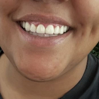 Riverside Dental Group At Woodcrest - I have so much gratitude for Dr. Jenney and her team - General Dentistry Near Me - Riverside, California Riverside Dental Group At Woodcrest - I have so much gratitude for Dr. Jenney and her team - General Dentistry Near Me - Riverside, California