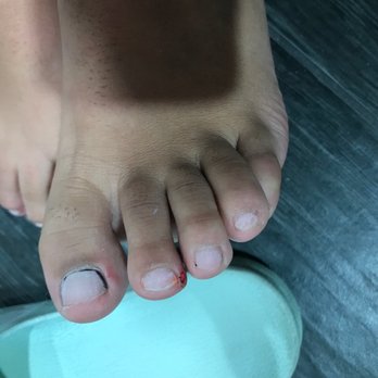 Avalon Nails & Spa - Were he cut me on one foot - Nail Salons Near Me - Clovis, California