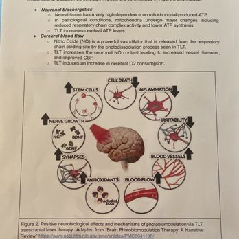 LaserMD Pain Relief - From the front office literature - Sports Medicine Near Me - Santa Monica, California LaserMD Pain Relief - From the front office literature - Sports Medicine Near Me - Santa Monica, California