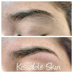 Kissable Skin