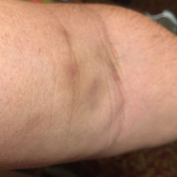 Quest Diagnostics - 4 days since blood draw - Laboratory Testing Near Me - Sacramento, California