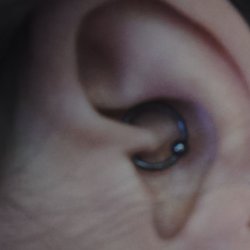 Picture of my Daith piercing (taken about 5 hours after it was pierced)
