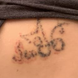 Sumit A Sitole, MD - Healing after the 3rd session