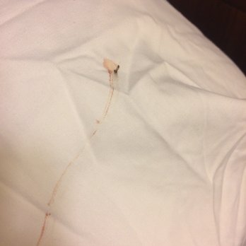 Comfort Inn University Area - This is the blood spot that was left after my mother squashed the damn bedbug - Hotels Near Me - Baton Rouge, Louisiana