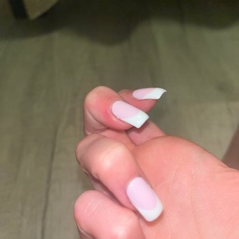 Fedora Kate Nails - middle finger all swollen and red on the side. - Nail Salons Near Me - Oak Brook, Illinois
