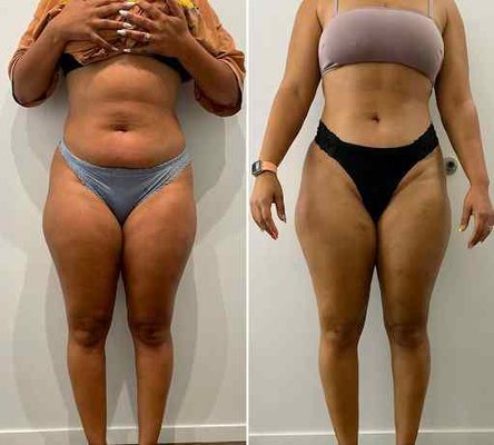 Lipo Lounge Jax by null