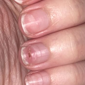 Clayton Nail Spa - ripped nail - Nail Salons Near Me - Clayton, Missouri Clayton Nail Spa - ripped nail - Nail Salons Near Me - Clayton, Missouri