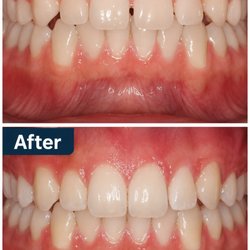 Foothill Dental Care: Jean Lee, DDS