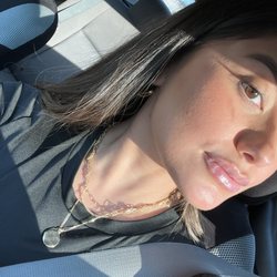 The Image Center - An hour after lip filler, so natural and plump!
