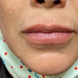 Absolutely Beautiful Permanent MakeUp and Microblading by Cathy - Before Full Lip Color