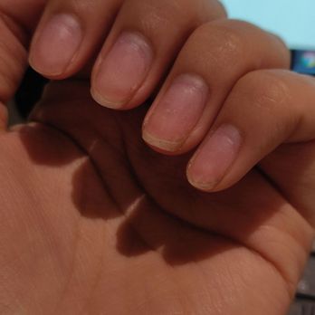 Nail Court - Nails after growing out - Nail Salons Near Me - Dallas, Texas Nail Court - Nails after growing out - Nail Salons Near Me - Dallas, Texas