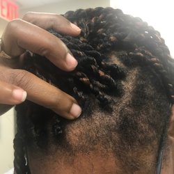 Far Rockaway African Hair Braiding - Two braids came out leaving this bald spot IN THE FRONT - Wtf do not go here ladies