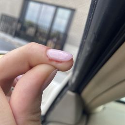 Bleeding nail Bleeding nail