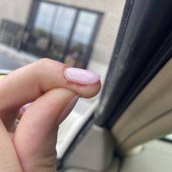Classy Nails and Spa - Bleeding nail