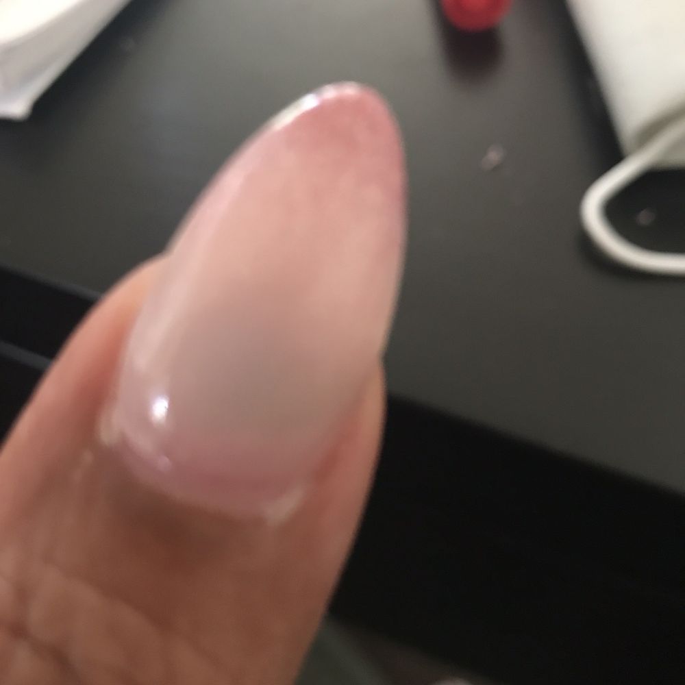Can you see the dark spot under the gel? That's a fungus.