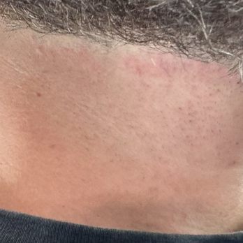 Back N Time Barber Shop - Irritated skin! - Barbers Near Me - Flower Mound, Texas Back N Time Barber Shop - Irritated skin! - Barbers Near Me - Flower Mound, Texas