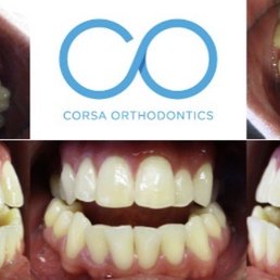 Before treatment Before treatment