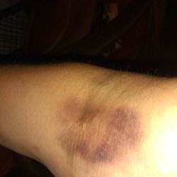 Octapharma Plasma
