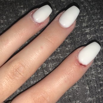 Nail Palace - Bleeding and dry cuticles - Nail Salons Near Me - Liberty Lake, Washington