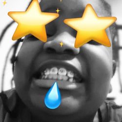 Degise Orthodontics - King jones