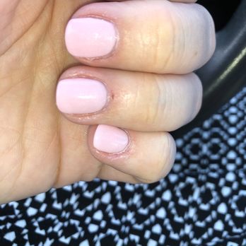 Sunrise Nails - Cut cuticle and uneven shaped nails. - Nail Salons Near Me - North Weymouth, Massachusetts
