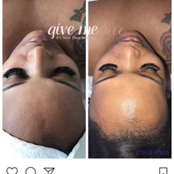 Healed By Tashi - Before and after.