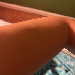 Susan's Seaside Spa - This is my healed arm after her work.