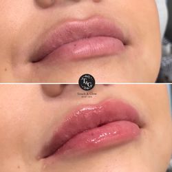 Touch and Glow Med Spa - Lips by Leo @thelipdude