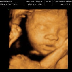 Expectations Ultrasound - Time for a nap