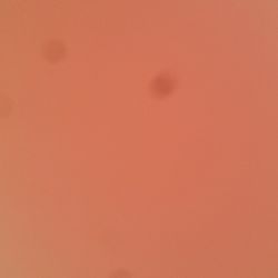 Cell Phone Doctor - I covered slightly covered my camera with my thumb to show the smudge