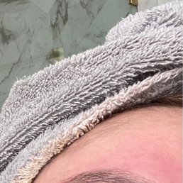 Skin burned from rough eye waxing...4 hrs after waxing.